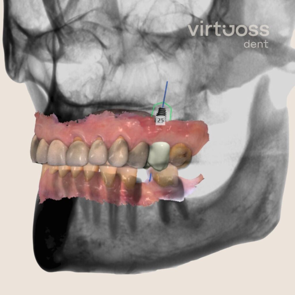 Digitální plánování zubní protetiky