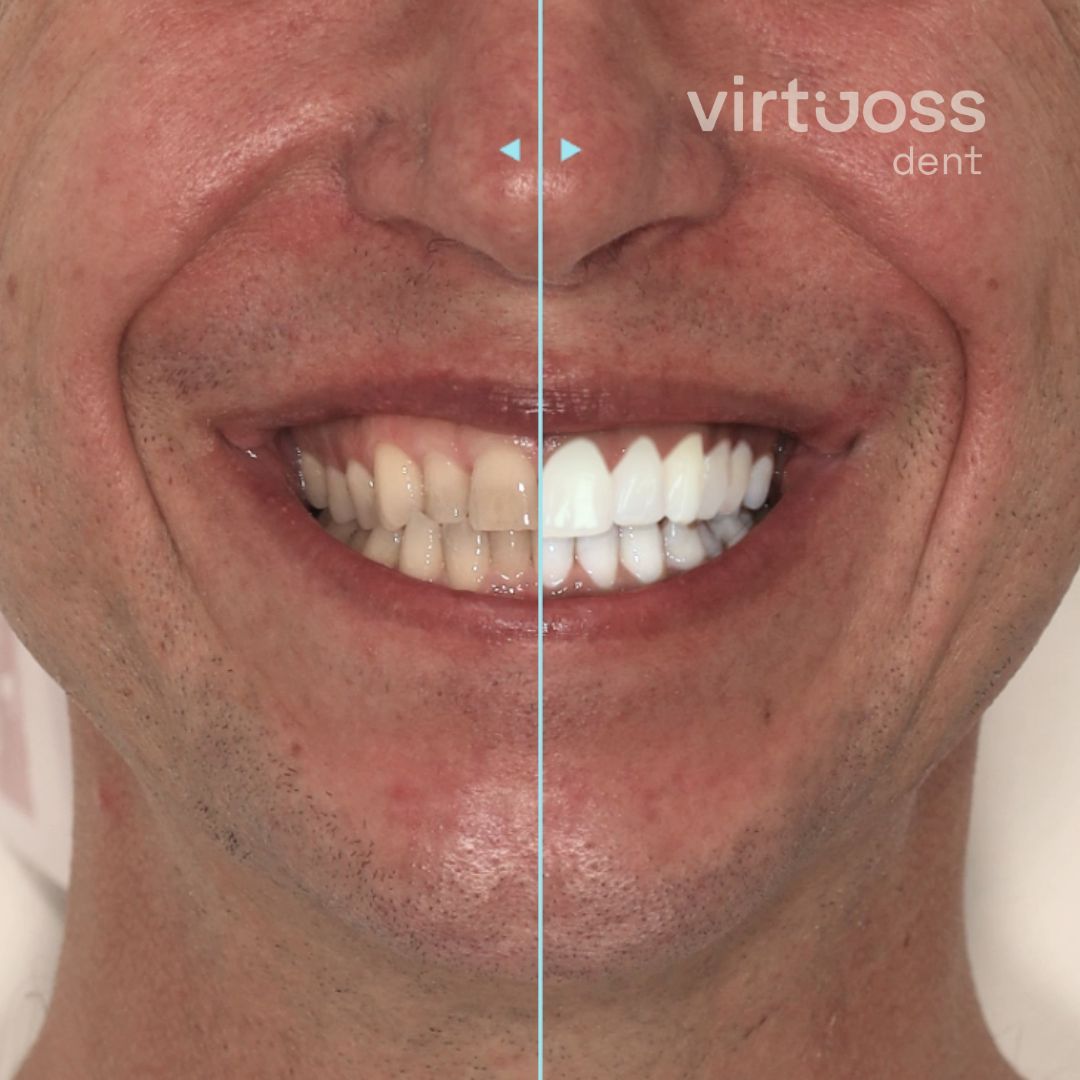 DSD digital smile design Praha Virtuoss dent 