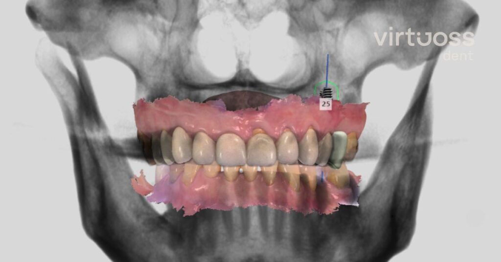 Digitální plánování zubní protetiky