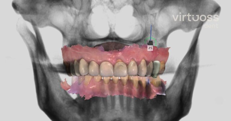 Digitální plánování zubní protetiky