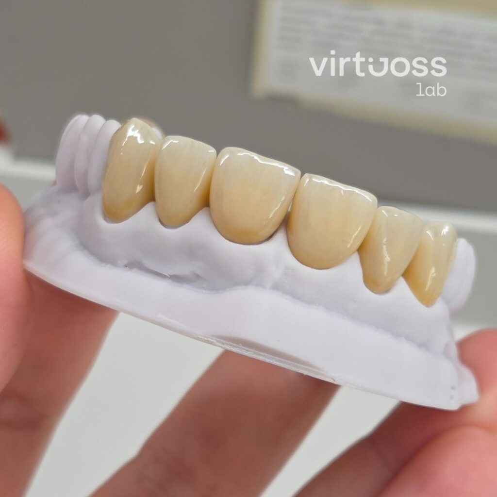 zirkonové korunky praha zubní laboratoř virtuoss lab